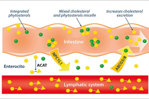 Schematic diagram of the intestine showing how phytosterols mix with cholesterol in micelles, reduce absorption via NPC1L1, and increase cholesterol excretion via ABCG5/8, with enterocytes and the lymphatic system labeled.